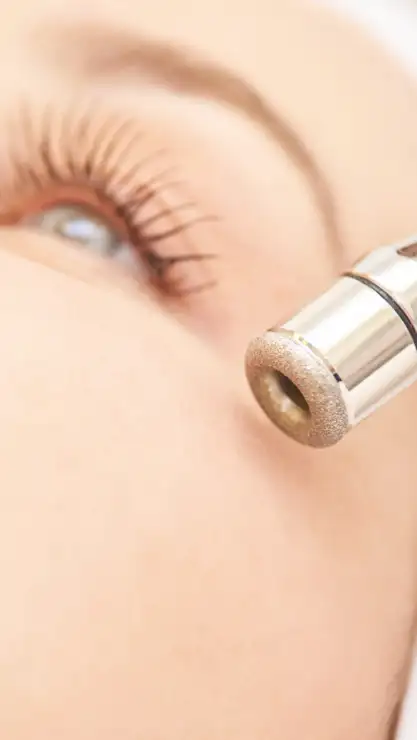 Mujer en segundo plano a punto de recibir una sesión de higiene facial con punta de diamante.